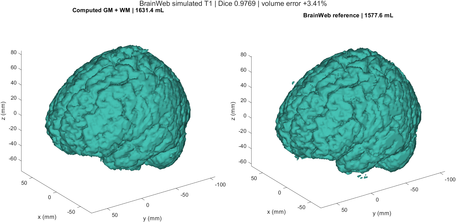 Computed human brain segmentation and BrainWeb reference shown as three-dimensional surfaces